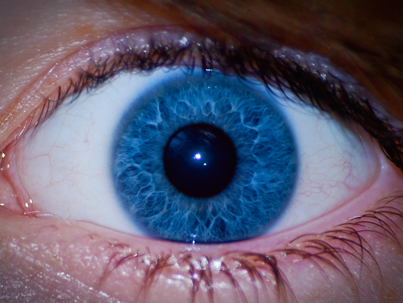 Chronic Inflammation Turns Eyes Into Skin | Inverse
